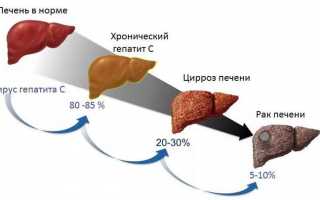 Лечение печени народными средствами: самые эффективные методы