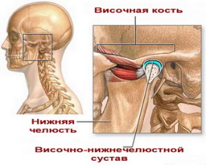 артроз височно нижнечелюстного сустава