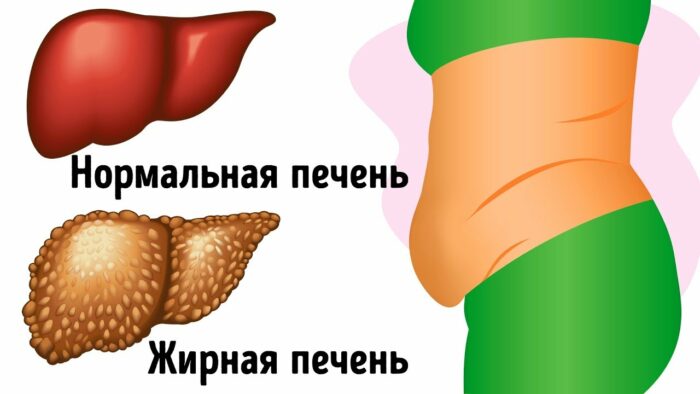 увеличенная печень