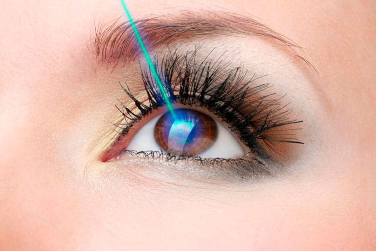 Lasik (Ласик)